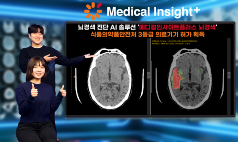 SK C&C, 뇌경색 진단 AI 솔루션 식약처 3등급 의료기기 허가 획득